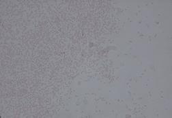 960px-Pantoea_agglomerans