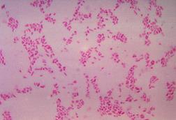 BacteroidesFragilis_Gram (3)