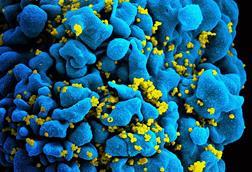 HIV-infected_T_cell_(6813384933)