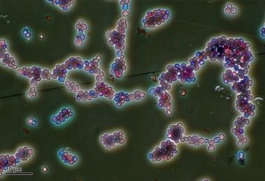 Candida_albicans_(251_12)