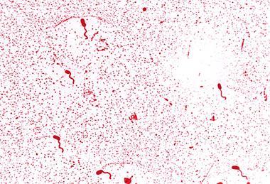 960px-Vibrio_cholerae_01