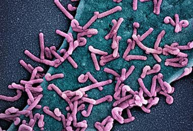 Marburg_virus_outbreak