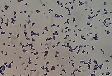 Leuconostoc_mesenteroides_Gram_Staining