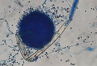 Aspergillus_niger_in_LPCB_Tease_Mount_at_1600X