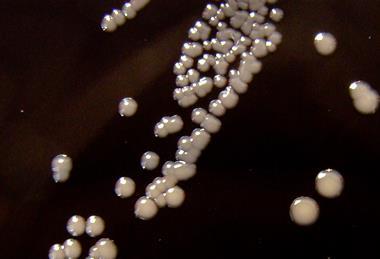 Bordetella_pertussis_on_Charcoal_Agar_supplemented_with_Cephalexin_-_Detail