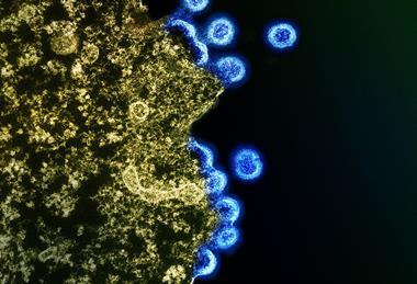 HIV_Virus_Particles_-_53567924670 (1)