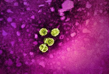 Hepatitis_B_Virus_(52451626575)