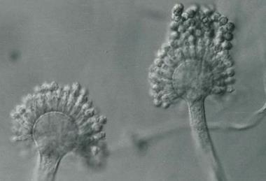 Aspergillus_parasiticus_UAMH5727a