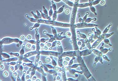 Trichoderma_harzianum