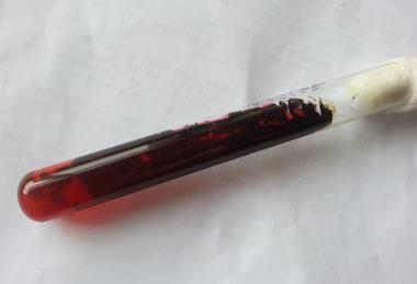 Ochroconis_gallopava_growth_on_SDA_after_4_days_of_incubation_showing_red_to_maroon_pigment_around_the_colony