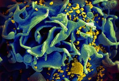 HIV-infected_T_cell_(6813489183)