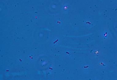 Geobacter_sulfurreducens.TIF