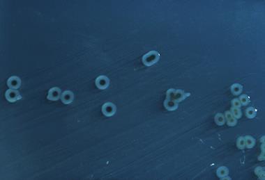 Salmonella_enterica_serovar_typhimurium_01