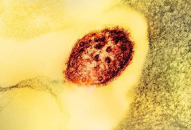 Measles_Virus_Particle