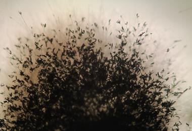 Aspergillus_fumigatus_microscope_view