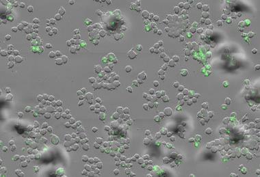 Low-Res_Mycobacterium tuberculosis (green) inside human immune cells known as macrophages