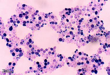 Candida_albicans_(248_35)