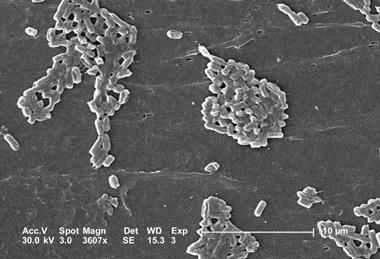 Esch_coli