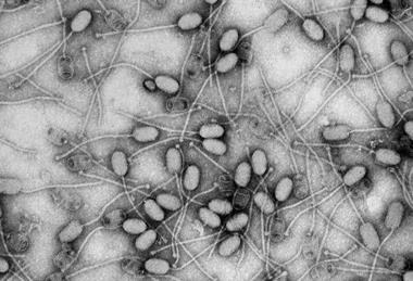 Phage_de_S_aureus_3A