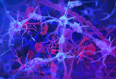 Low-Res_readhead-microglia-banner