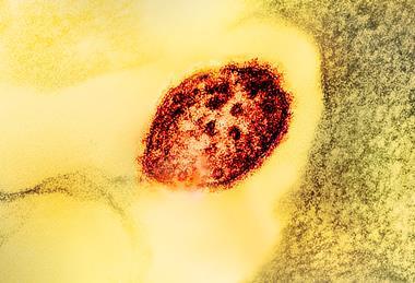 Measles_Virus_Particle