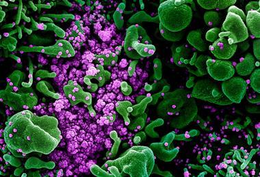 Novel_Coronavirus_SARS-CoV-2_(49666286236)