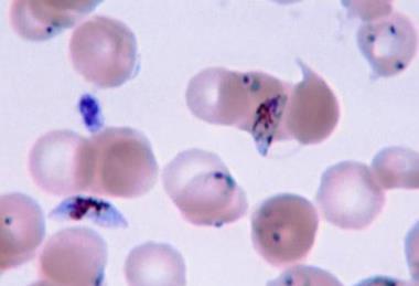Plasmodium
