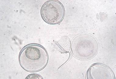 Coscinodiscus_granii