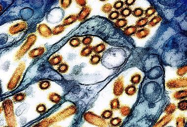 H5N1_avian_influenza