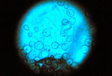 Aspergillus_nidulans_(15490521828)