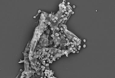methanogens2