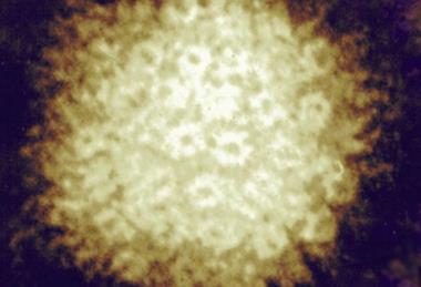 Varicella-zoster_Virus_(5614251360)