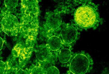 pexels-cdc-library-3992943 (1)