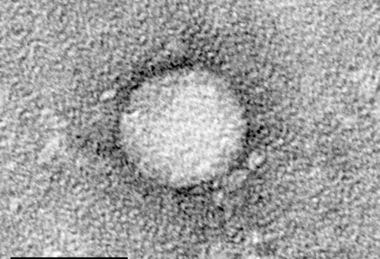 HCV_EM_picture_2