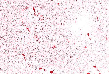 Vibrio_cholerae_01