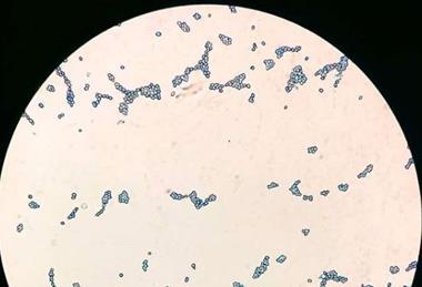 Saccharomyces_cerevisiae