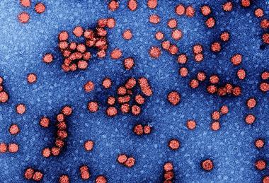 Hepatitis_b