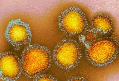Colorful_photo_of_influenza_particles.webp