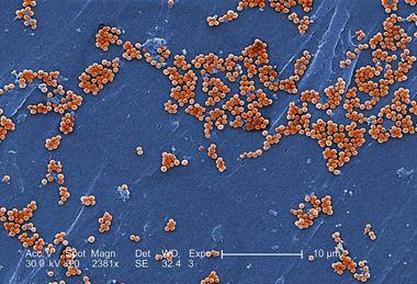 Methicillin-resistant_Staphylococcus_aureus_10048 (1)