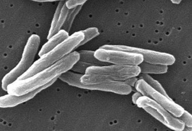 Mycobacterium_tuberculosis