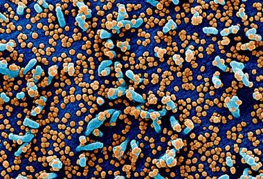 Novel_Coronavirus_SARS-CoV-2_(49680384436)