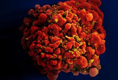HIV-infected_H9_T_Cell_(6813314147)