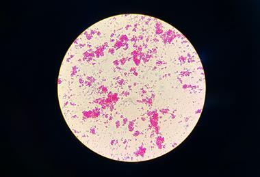 Nontuberculous_Mycobacteria_(NTM)_in_Ziehl-Neelsen_Staining_from_Positive_MGIT_Culture (1)