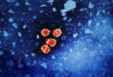 Hepatitis_B_Virus_(52444068124)