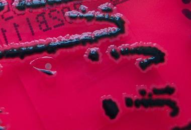 Salmonella_species_growing_on_XLD_agar_-_Showing_H2S_production_-_Detail