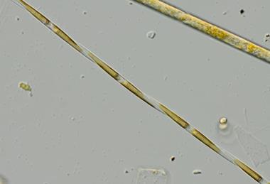 Low-Res_Image_503_Pseudo-nitzschia_CW_PML