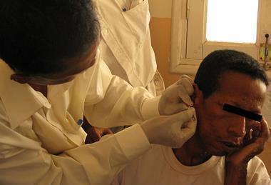 Madagascar_slit_skin_smear_taking_right_earlobe_-_Madagascar_2008