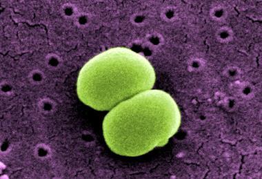 scanning-electron-micrograph-of-two-staphylococcus-epidermidis-bacteria-1536x904