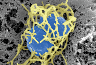 Neisseria_meningitidis_Charles-Orszag_2018