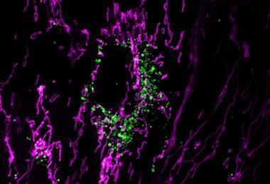 Low-Res_rehman-lab-mitokeima-hlmvec-oa-maggreen